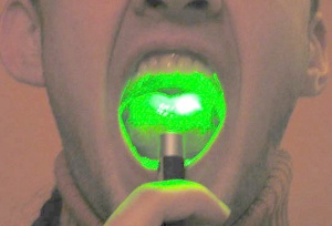 Laser mouth.jpg